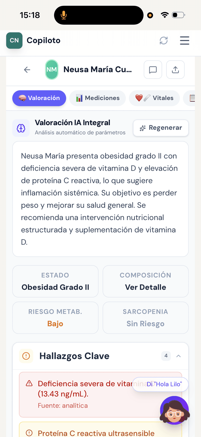 Valoración IA